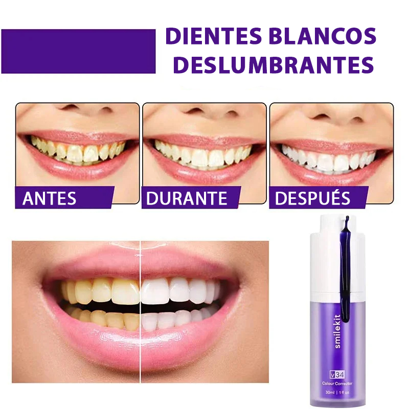 Blanqueador Dental Smile® - Dientes Blancos En Segundos ORIGINAL